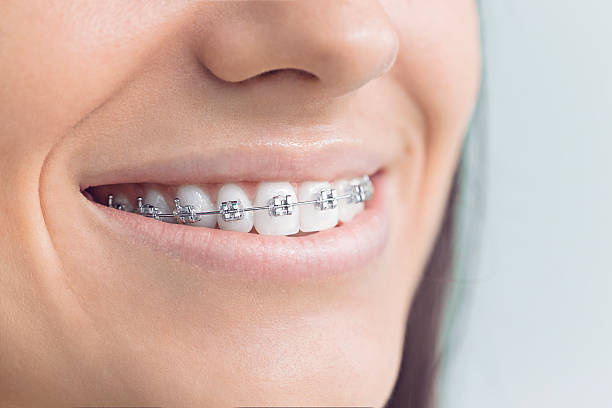 Why Choose Us for Your Dental Needs in Fort Scott, KS